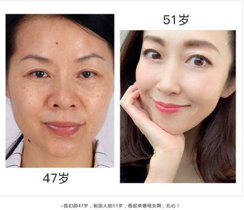 负离子 负离子