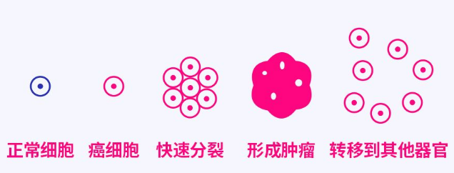 负氧离子防治癌症 负氧离子防治癌症