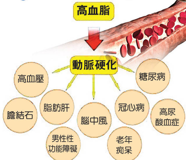 小粒径负氧离子能够对高血脂的防治发挥显而易见的影响 小粒径负氧离子能够对高血脂的防治发挥显而易见的影响